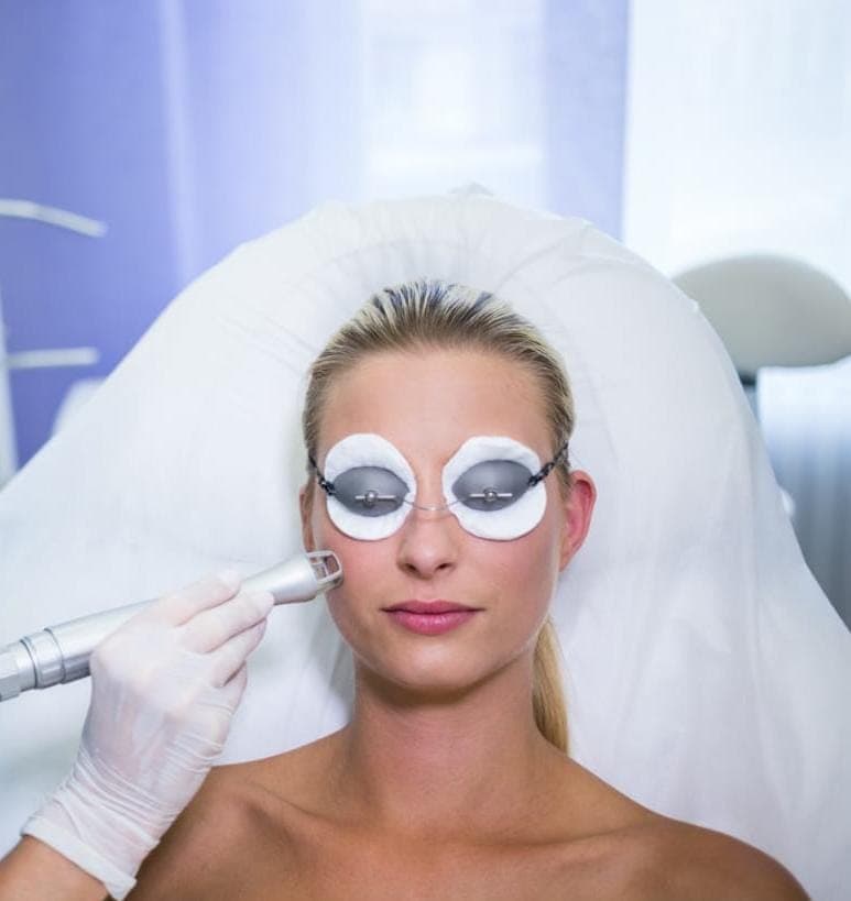 Traitement du mélasma - Supremacy and Perfect